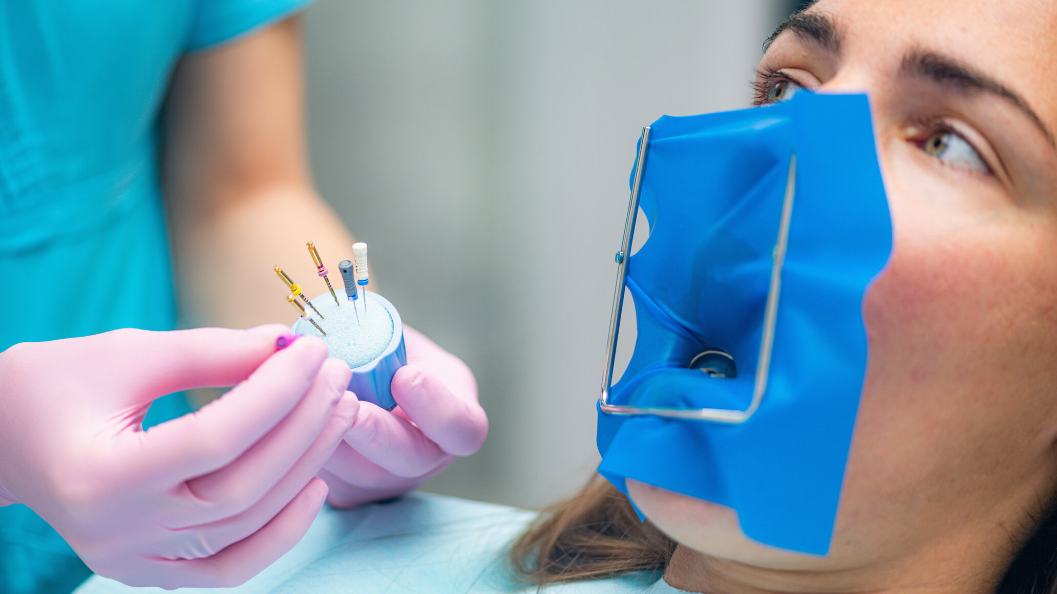Root Canal Treatment Luton